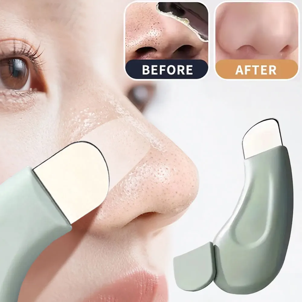 Facial Blackhead Removal Tool, - Nasal Aspirator review and price